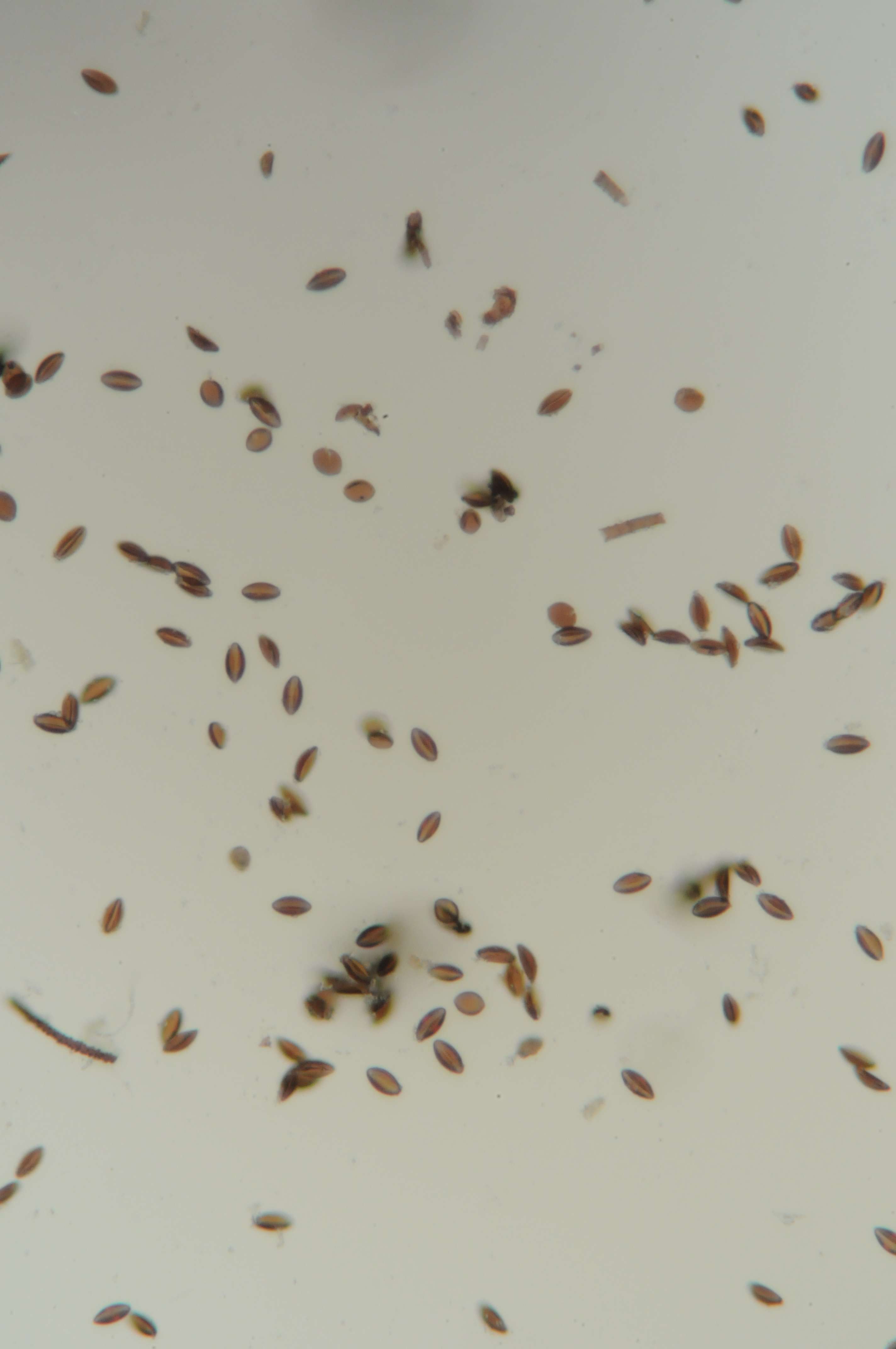 Aiuto riconoscimento spore fungine